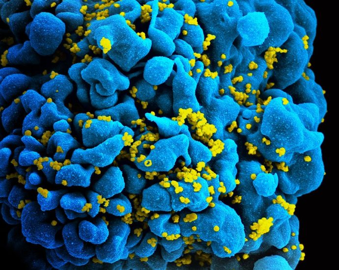 Scanning electromicrograph of an HIV-infected T cell. Credit: NIAID